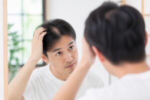 つむじはげの隠し方でおすすめのスタイリングテクニックは？