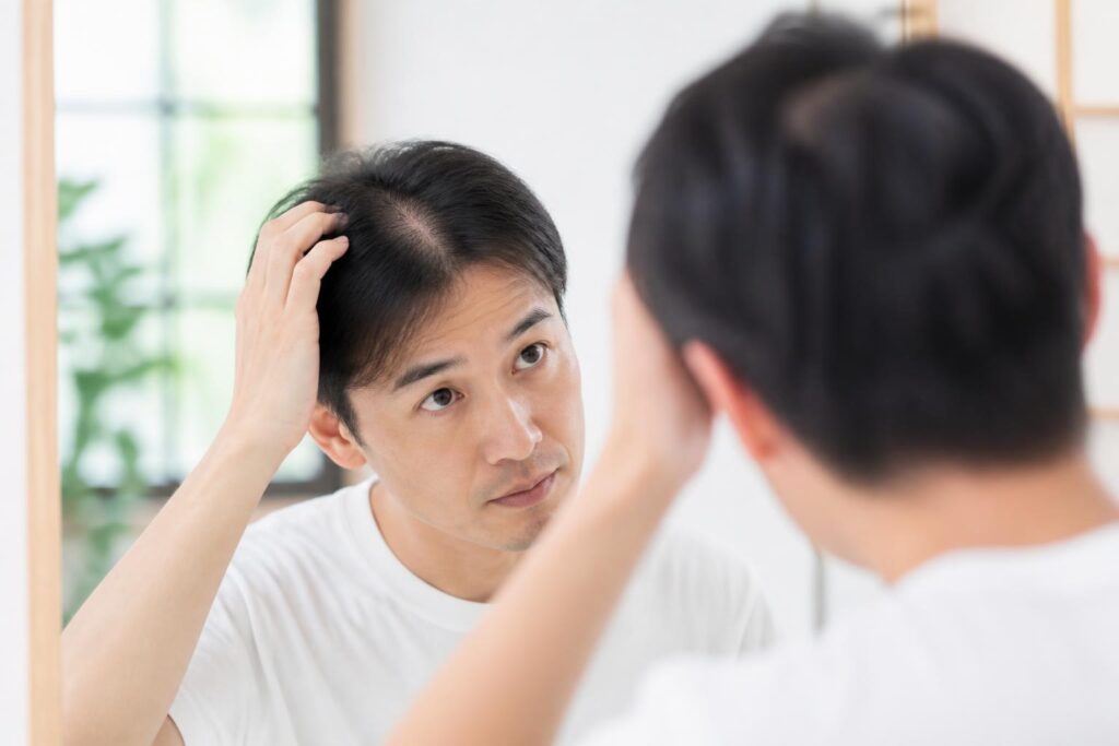 薄毛対策における季節の変わり目の注意点は？