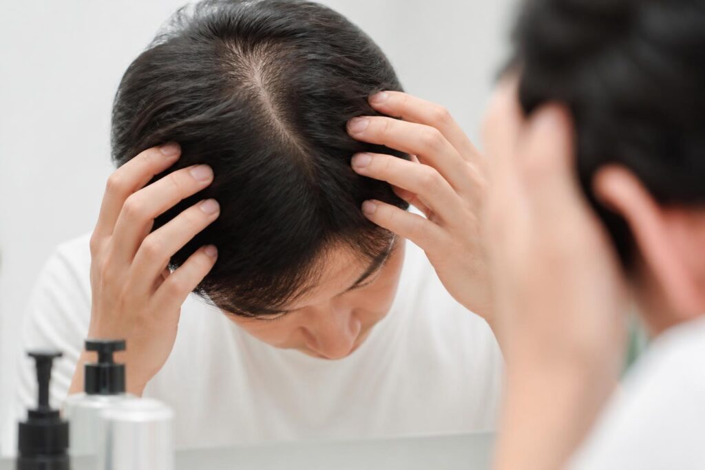 40代女性のつむじ薄毛に最適な育毛剤の副作用とは？