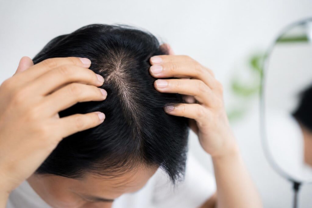 薄毛を気にするあなたにおすすめの髪型はどれ？